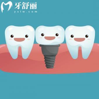 當?shù)厝送扑]阿克蘇種植牙比較好的醫(yī)院:蘇和/康美/中山口腔這幾家醫(yī)院種植牙好價格又便宜