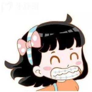 兒童牙齒矯正需要多久完成？牙套選擇/副作用/保持器等問題解答