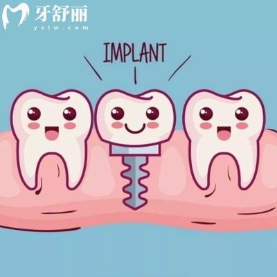 2024合肥牙科口腔醫(yī)院收費價目表全:含美奧/貝杰比較好的口腔種植矯正價格