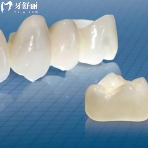 威海哪里看牙比較好還便宜？威海中諾/華怡/華海等口腔來推薦