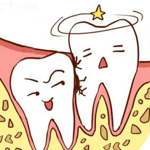 智齒爛個(gè)洞是拔還是補(bǔ)?本文來揭秘具體的解決方法