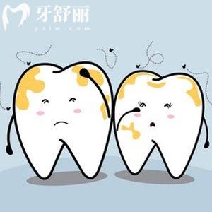 兒童去牙漬的方法有哪些?這里有去牙漬的方法小妙招