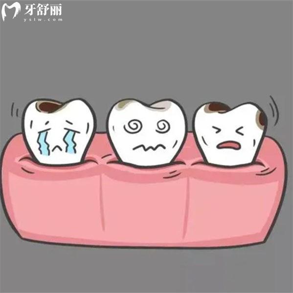 根尖周炎消不下去能不能拔牙?這里有根尖周炎的治療方法請(qǐng)熟知