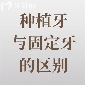 種植牙與固定牙的區(qū)別是什么？材質(zhì)-結(jié)構(gòu)-功能-美觀度皆不同
