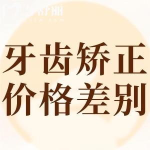 ?不同類(lèi)型牙齒矯正價(jià)格差別大嗎?通過(guò)國(guó)內(nèi)正畸價(jià)格一覽表來(lái)看很不同