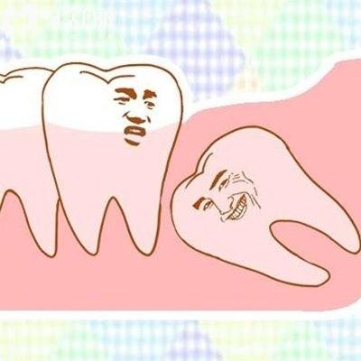 解答疑惑:埋伏牙拔除是大手術(shù)嗎?什么樣的埋伏牙不用拔除?