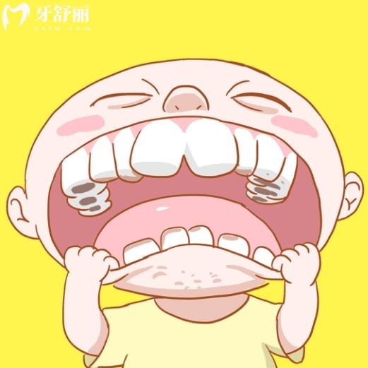 孩子蛀牙有黑窟窿還能治嗎？這份兒童補牙須知手冊請收好