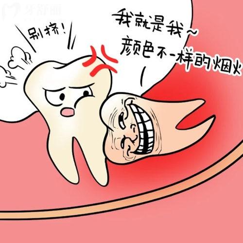智齒能不拔盡量不拔?牙醫(yī)來告知哪些需要拔除/哪些不需要拔除?