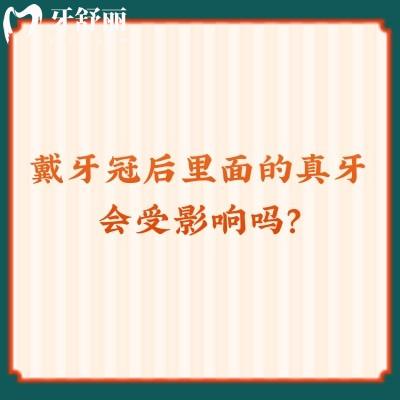 戴牙冠后里面的真牙會受影響嗎？長時間后是會有部分影響