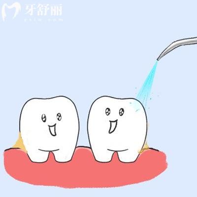 睡眠潔牙和普通潔牙的區(qū)別對(duì)比,看看哪種潔牙方式更舒適?
