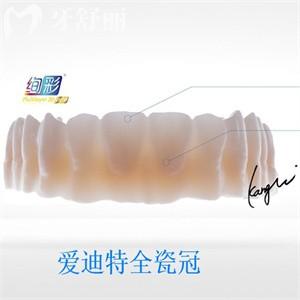 愛迪特全瓷冠有幾個型號?6款全瓷+1款樹脂材料滿足不同患者需求