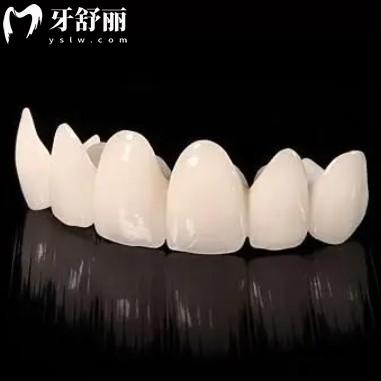 愛爾創(chuàng)全瓷牙冠種類型號和價格表公布，看完就知道怎么選更合適