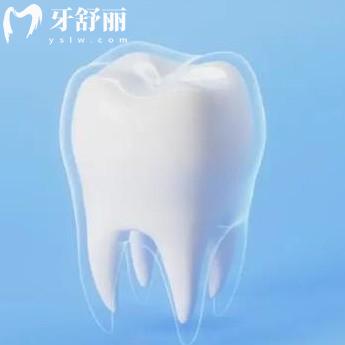 嵌體和牙冠哪個好?從各自的區(qū)別和優(yōu)缺點了解下