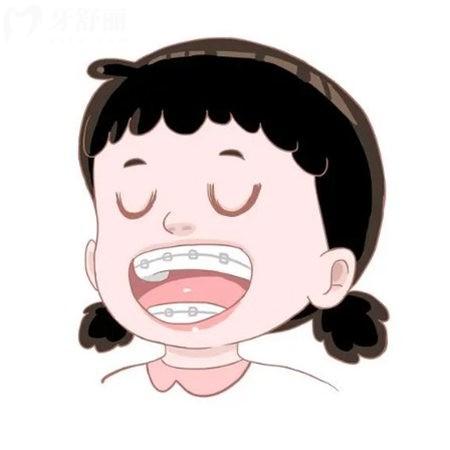 兒童早期干預(yù)矯正2歲開始有必要嗎?有,兒童牙齒早期矯正利弊寶媽必知