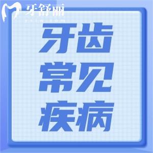 牙齒常見疾病圖片集:來了解下預防和治療方法有哪些吧