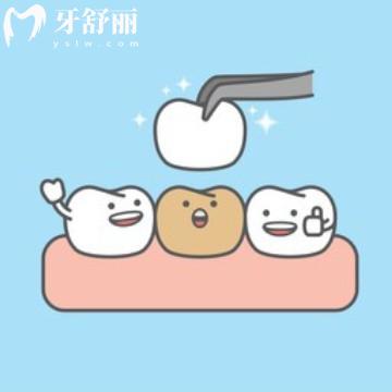 牙齒美容主要都有什么項目？矯正/美白/牙冠/貼面都屬于