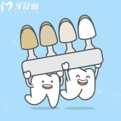 牙貼面做8顆還是16顆更好？盤點不同材質(zhì)貼面應(yīng)該如何選擇