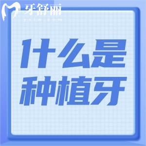 什么是種植牙?有哪些優(yōu)缺點(diǎn)?