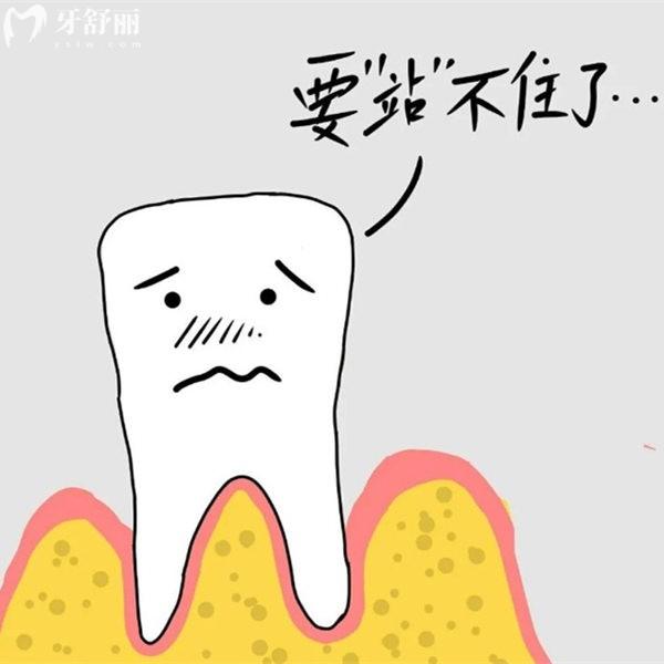 患上牙周炎對(duì)種植牙有影響嗎?可能會(huì)導(dǎo)致種植牙失敗喲
