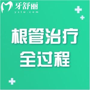 牙齒根管治療全過(guò)程圖片演示:步驟多治療需耐心還有價(jià)格分享