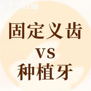 固定義齒和種植牙哪個(gè)好?通過(guò)安裝過(guò)程圖解來(lái)了解下區(qū)別吧