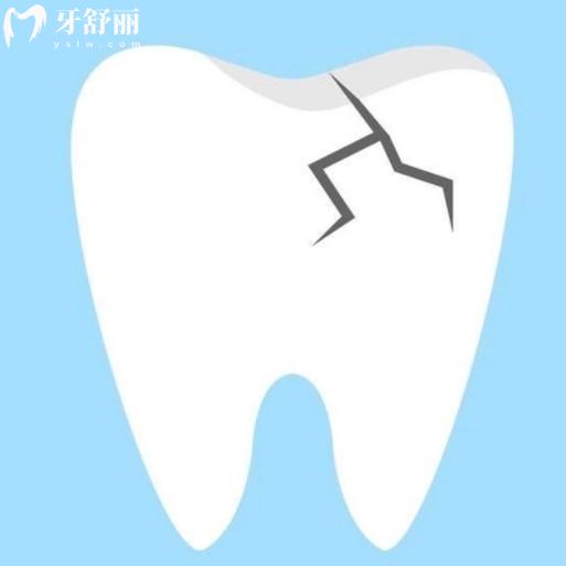 根管治療完牙裂了怎么辦？如何補(bǔ)救？真的需要戴牙冠嗎？本篇解答