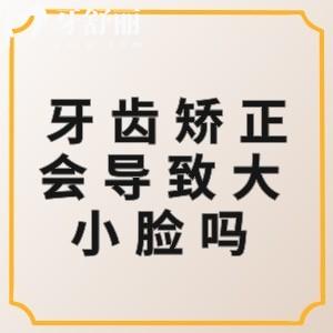 ?牙齒矯正會導(dǎo)致大小臉嗎？現(xiàn)在矯正技術(shù)已成熟會不適但不會大小臉