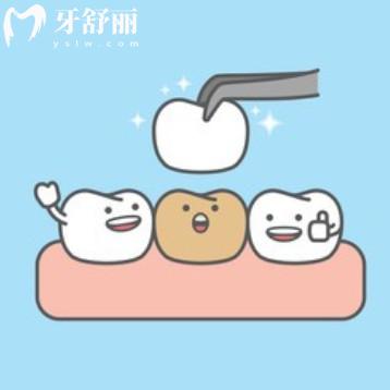 烤瓷牙在什么情況下必須拆除？還有不同金屬烤瓷牙的優(yōu)勢解讀