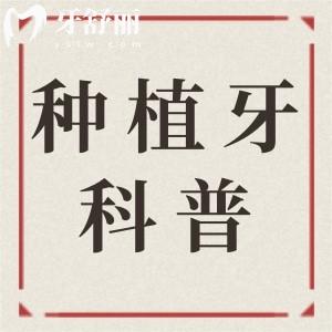 種植牙是選越貴的越好嗎?2025年全新種植體十大品牌排行榜及價格公開