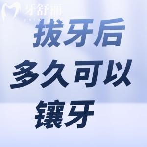 拔牙后多久可以鑲牙?鑲什么牙好?