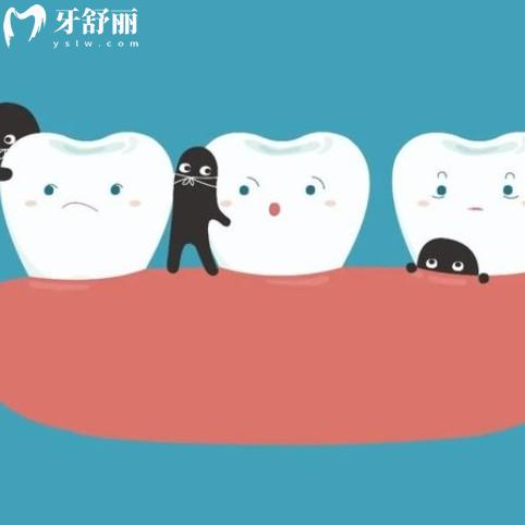 非常常見的六大食物竟然是蛀牙主要元兇，牙友可以收藏慢慢看
