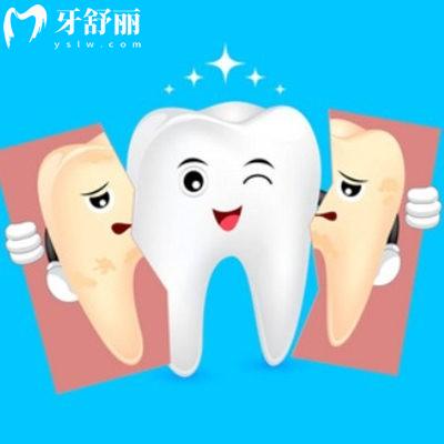 牙齒美白的方法哪種有效？是不是智商稅？
