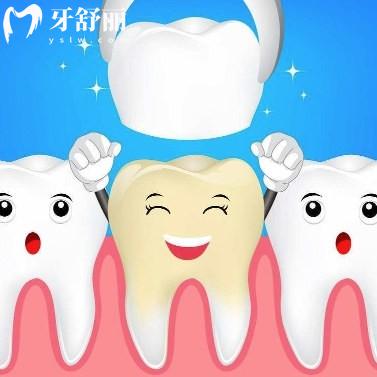 做牙冠一般建議選什么樣的材料?