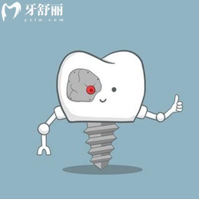 湛江市珠江口腔醫(yī)院是私立醫(yī)院嗎?靠譜嗎?價格貴不貴？