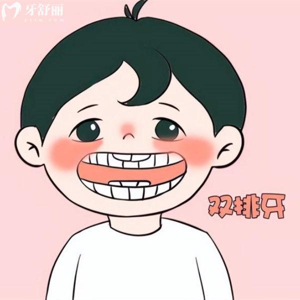 北京積水潭醫(yī)院口腔科價格表分享:正規(guī)牙科種植正畸收費(fèi)不高