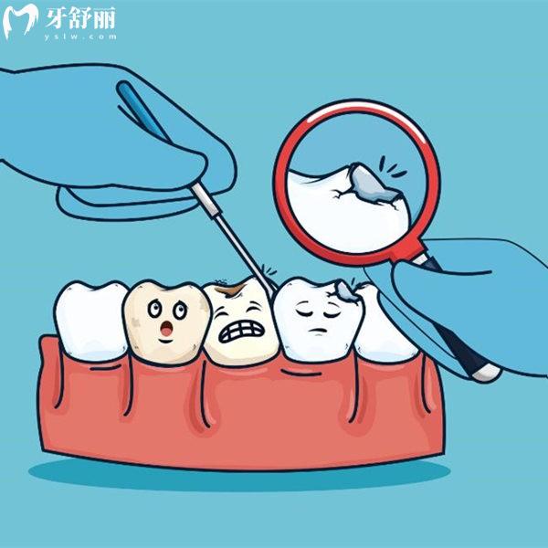 齲壞后補(bǔ)了牙的牙齒還會爛到牙髓么?