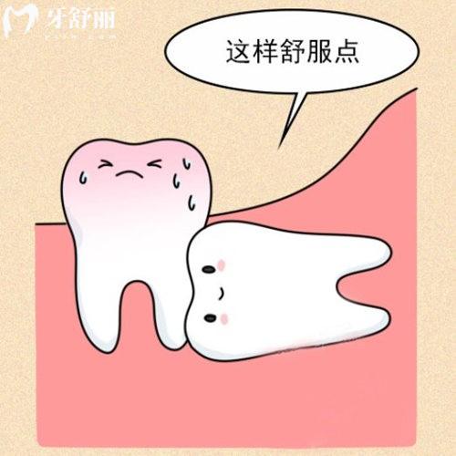 簡單智齒和復(fù)雜智齒如何判斷?