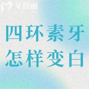 中度四環(huán)素牙怎樣能變白