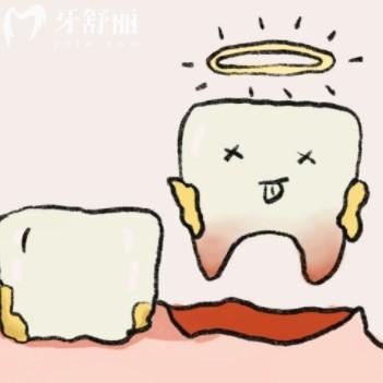 先洗牙還是先拔牙補牙？