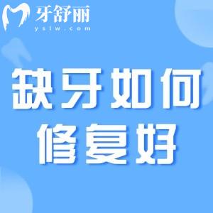 缺牙時種牙齒好還是鑲牙齒好?