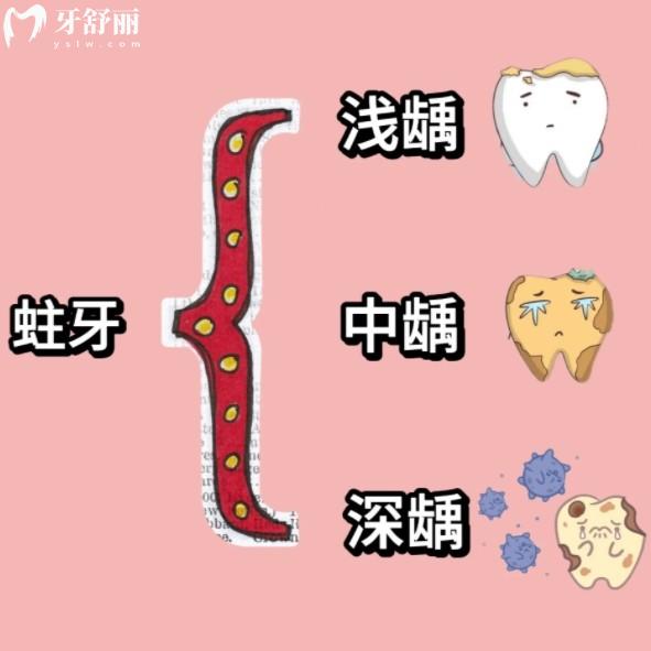 蛀牙不疼也要補是過度醫(yī)療嗎？