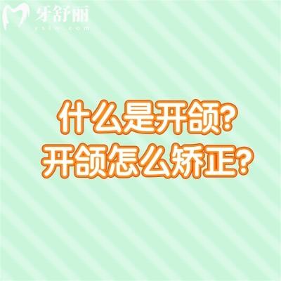 什么是開頜？開頜怎么矯正？一文了解開頜的定義與解決方法