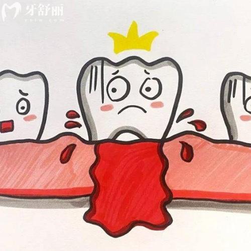 牙齦萎縮的地方能補起來嗎?不能,牙齦萎縮的治療方法安利給大家
