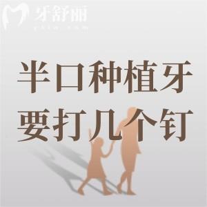 半口種植牙要打幾個(gè)釘？選擇ALL-ON-4/6種植方案只需4顆和6顆即可