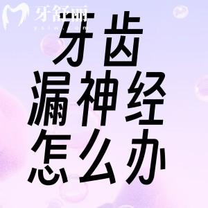 牙齒漏神經(jīng)了怎么辦?這些牙漏神經(jīng)治療方法和注意事項必須知道!