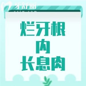 爛牙根里長息肉怎么治療？這種情況應(yīng)及時(shí)處理醫(yī)生會(huì)給出適合的方案哦