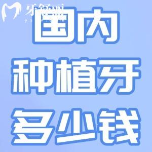 2025國內(nèi)種植牙收費(fèi)多少錢?盤點(diǎn)十大種植體品牌價(jià)格及全口種植牙收費(fèi)明細(xì)