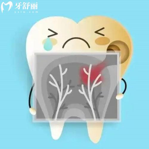 ?牙髓壞死的牙齒還有救嗎?建議到正規(guī)牙科做根管治療或拔牙等