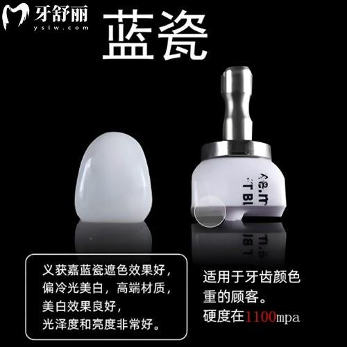 詳細(xì)介紹義獲嘉藍(lán)瓷牙貼面利弊:市場價格單顆1800元起可放心選