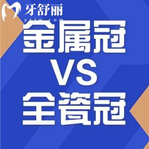 600元的金屬冠和900元的全瓷冠哪個(gè)好?對(duì)比金屬牙和全瓷牙三大區(qū)別就了解